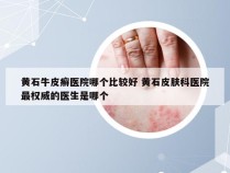 黄石牛皮癣医院哪个比较好 黄石皮肤科医院最权威的医生是哪个