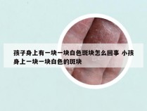 孩子身上有一块一块白色斑块怎么回事 小孩身上一块一块白色的斑块