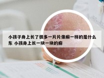 小孩子身上长了很多一片片像癣一样的是什么东 小孩身上长一块一块的癣