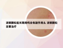 消银颗粒能长期用吗会有副作用么 消银颗粒主要治疗