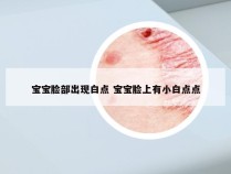 宝宝脸部出现白点 宝宝脸上有小白点点