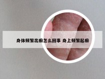 身体频繁出癣怎么回事 身上频繁起癣