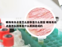 眼珠有白点是怎么回事是什么原因 眼珠有白点是怎么回事是什么原因造成的