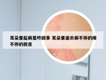 耳朵里起癣是咋回事 耳朵里面长癣不停的痒不停的脱皮