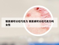 银屑病可以吃巧克力 银屑病可以吃巧克力吗女性