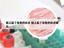 腿上起了白色的白点 腿上起了白色的白点图片