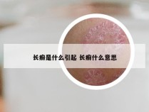 长癣是什么引起 长癣什么意思