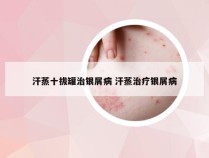 汗蒸十拔罐治银屑病 汗蒸治疗银屑病