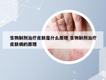 生物制剂治疗皮肤是什么原理 生物制剂治疗皮肤病的原理