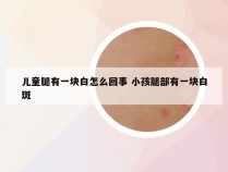 儿童腿有一块白怎么回事 小孩腿部有一块白斑