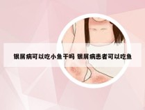 银屑病可以吃小鱼干吗 银屑病患者可以吃鱼