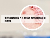 南京治银屑病现代长城顶尖 南京治疗银屑病的费用