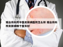 烟台农科院中医皮肤病医院怎么样 烟台农科院皮肤病哪个医生好