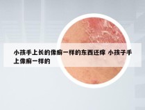 小孩手上长的像癣一样的东西还痒 小孩子手上像癣一样的