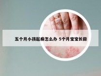 五个月小孩起癣怎么办 5个月宝宝长藓