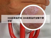 308白斑治疗仪 308白斑治疗仪哪个牌子好