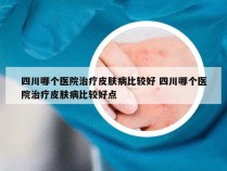 四川哪个医院治疗皮肤病比较好 四川哪个医院治疗皮肤病比较好点