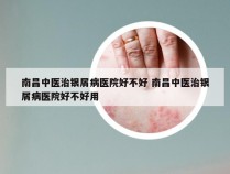 南昌中医治银屑病医院好不好 南昌中医治银屑病医院好不好用