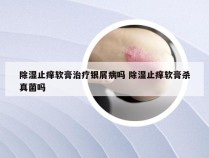 除湿止痒软膏治疗银屑病吗 除湿止痒软膏杀真菌吗