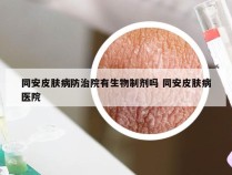 同安皮肤病防治院有生物制剂吗 同安皮肤病医院