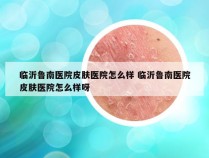 临沂鲁南医院皮肤医院怎么样 临沂鲁南医院皮肤医院怎么样呀