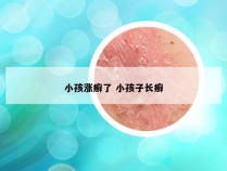 小孩涨癣了 小孩子长癣