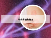 牛皮癣病友秘方