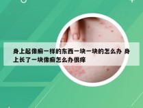 身上起像癣一样的东西一块一块的怎么办 身上长了一块像癣怎么办很痒