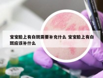 宝宝脸上有白斑需要补充什么 宝宝脸上有白斑应该补什么