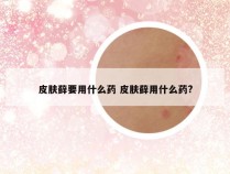 皮肤藓要用什么药 皮肤藓用什么药?