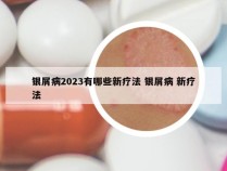 银屑病2023有哪些新疗法 银屑病 新疗法