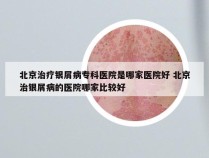 北京治疗银屑病专科医院是哪家医院好 北京治银屑病的医院哪家比较好