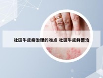 社区牛皮癣治理的难点 社区牛皮鲜整治