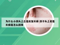 为什么小孩头上总是反复长癣 孩子头上老是长癣是怎么回事