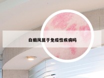 白癜风属于免疫性疾病吗