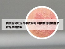 构树脂可以治疗牛皮癣吗 构树皮提取物在护肤品中的作用