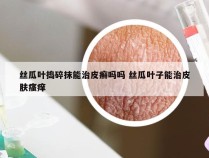 丝瓜叶捣碎抹能治皮癣吗吗 丝瓜叶子能治皮肤瘙痒