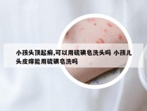 小孩头顶起癣,可以用硫磺皂洗头吗 小孩儿头皮痒能用硫磺皂洗吗