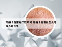 疗癣卡西甫丸疗效如何 疗癣卡西甫丸怎么吃成人吃几丸