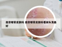 南京哪家皮肤科 南京哪家皮肤科看掉头发最好