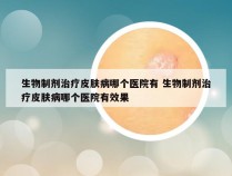 生物制剂治疗皮肤病哪个医院有 生物制剂治疗皮肤病哪个医院有效果