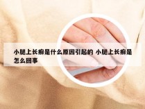 小腿上长癣是什么原因引起的 小腿上长癣是怎么回事