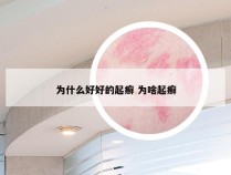 为什么好好的起癣 为啥起癣