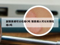 副银屑病可以吃维C吗 银屑病人可以长期吃维c吗