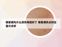 银屑病为什么到热带就好了 银屑病热点好还是冷点好