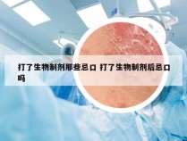 打了生物制剂那些忌口 打了生物制剂后忌口吗