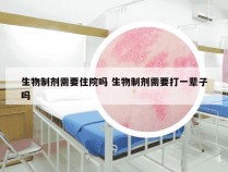 生物制剂需要住院吗 生物制剂需要打一辈子吗