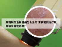 生物制剂治银屑病怎么治疗 生物制剂治疗银屑病有哪些利弊?