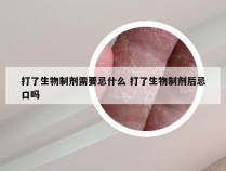 打了生物制剂需要忌什么 打了生物制剂后忌口吗