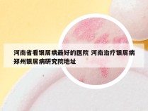 河南省看银屑病最好的医院 河南治疗银屑病郑州银屑病研究院地址